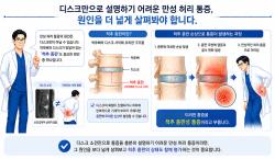 디스크만으로 설명 어려운 만성 허리 통증…척추 종판도 확인