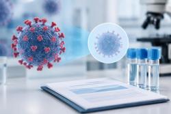 STP0404 2a상 결과보고서 수령…HIV-1 RNA 감소